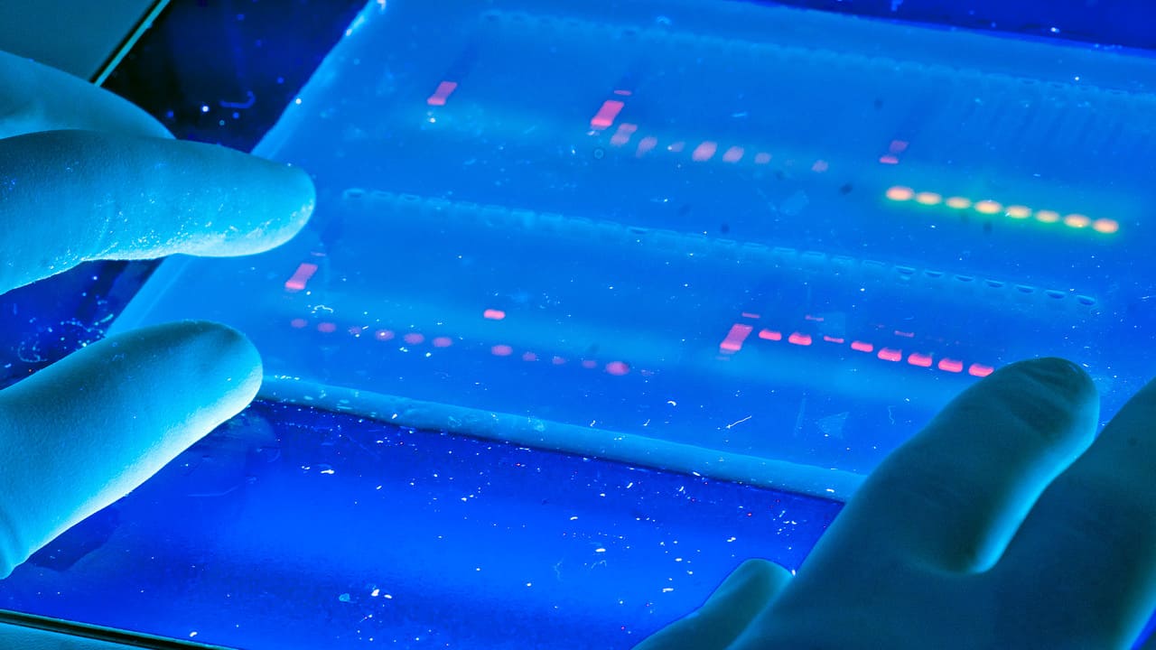 Gel-Electrophoresis